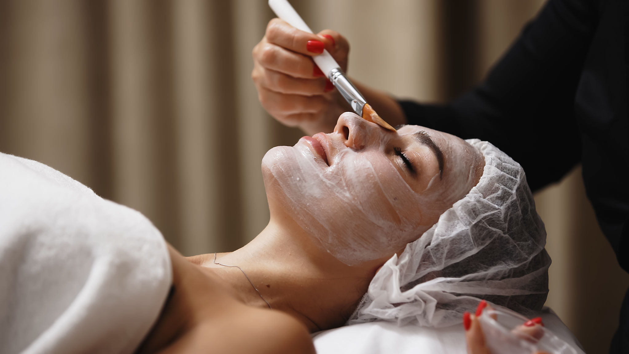 chemical peel