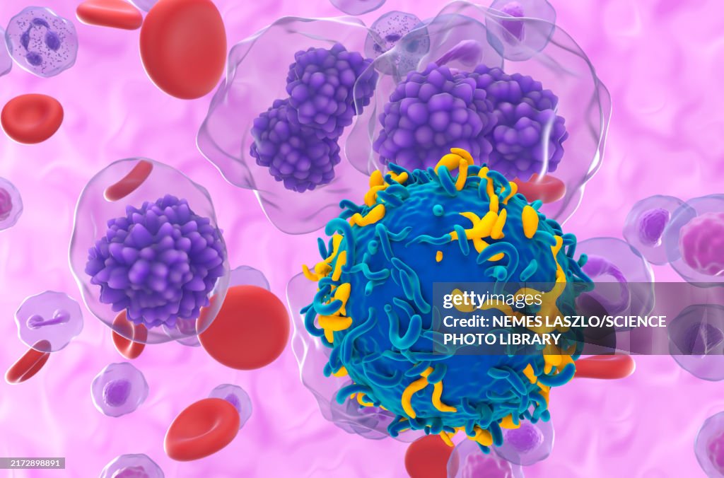 CAR-T cell therapy for plasma cell leukaemia, illustration