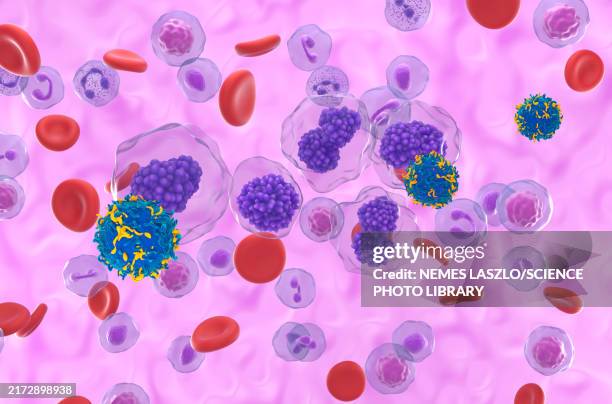 illustrations, cliparts, dessins animés et icônes de car-t cell therapy for plasma cell leukaemia, illustration - cellule
