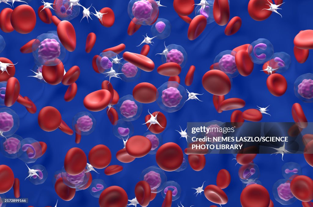 Polycythaemia vera blood cancer, illustration