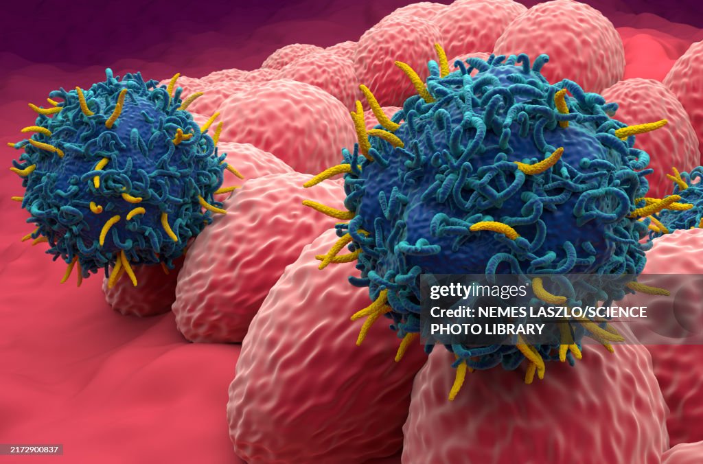 CAR-T cell therapy for endometrial cancer, illustration