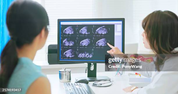 doctor explain woman uterus ultrasound - uterine cancer stock pictures, royalty-free photos & images