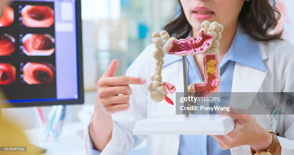 Consulta médica después de la colonoscopia