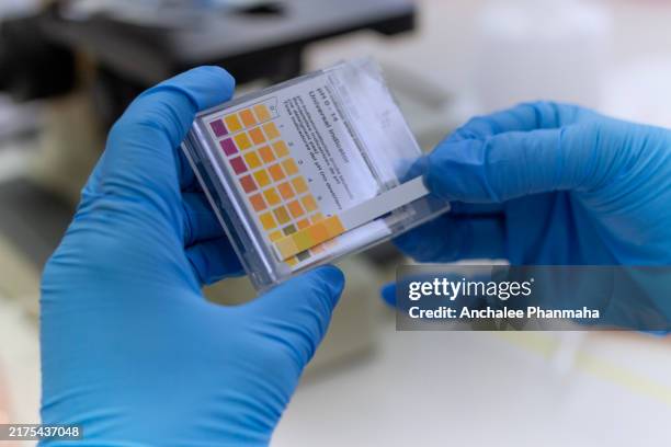 a gloved hand holding a urine dipstick test kit. the test kit displays a color chart used to compare the ph results of a urinalysis. - urine sample stock pictures, royalty-free photos & images