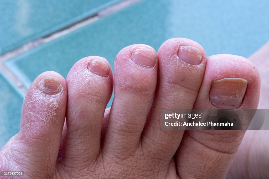 An image of dry, cracked skin, illustrating dehydration and lack of moisture, potentially caused by dry weather or insufficient skin care.