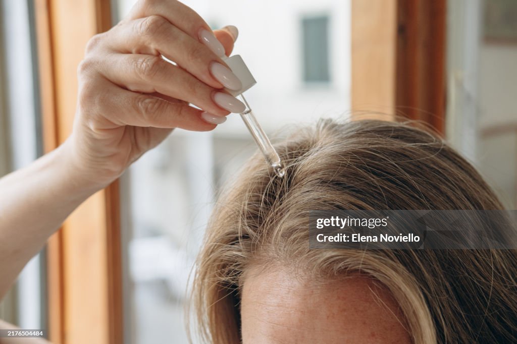 Woman drops hair growth serum or hair oil with a dropper , hair care
