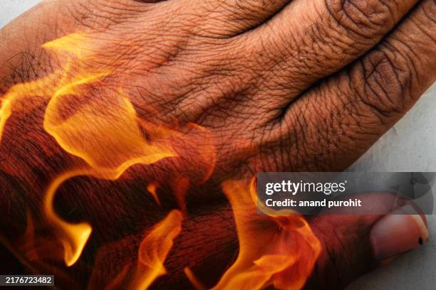 stay safe from fire while working - human skin stock pictures, royalty-free photos & images