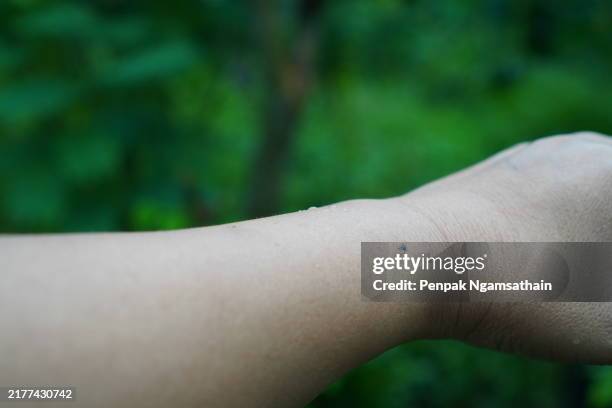aedes mosquito bites on the arm - succhiare il sangue foto e immagini stock