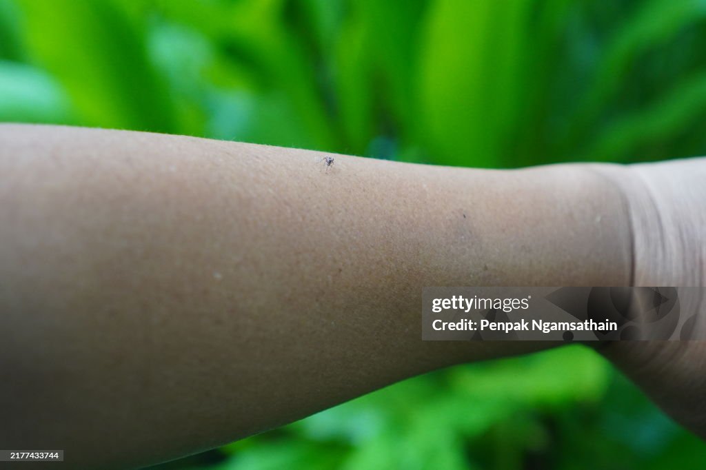 Aedes mosquito bites on the arm