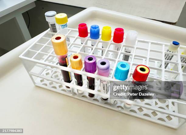 Blood test for clinical trial, Charing Cross Hospital. October 2024,London .