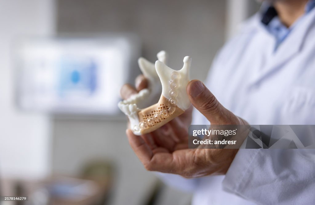 Nahaufnahme eines Zahnarztes, der ein Zahnimplantat betrachtet