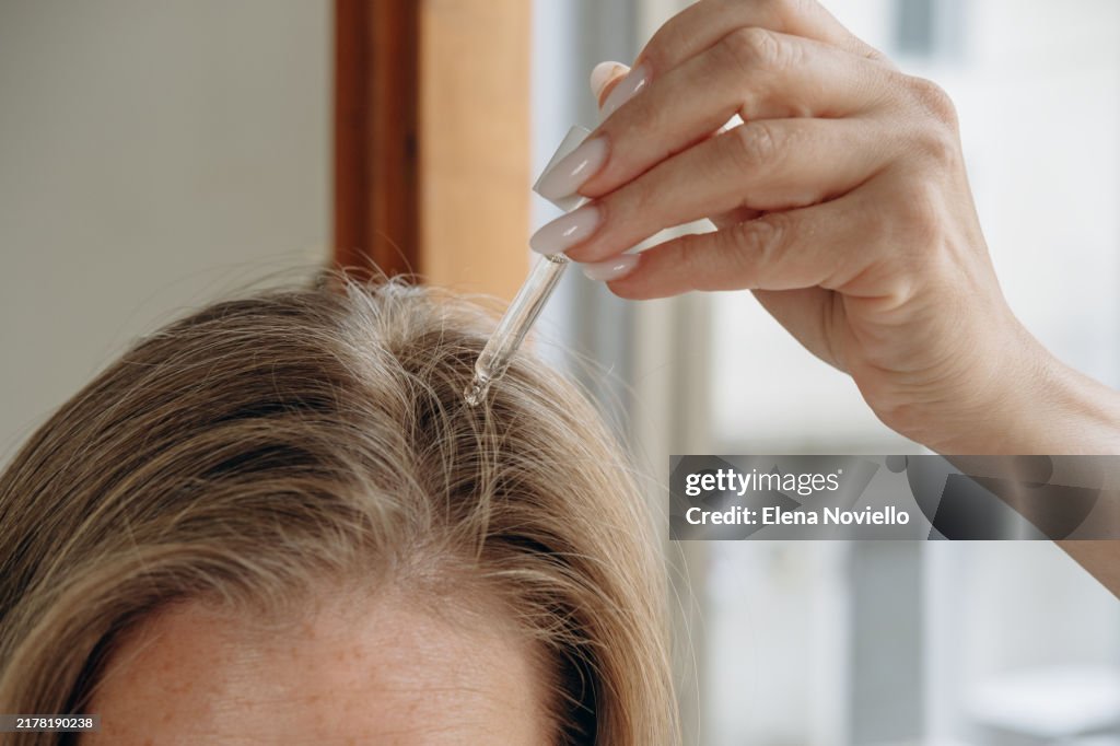 Close-up of a woman's hands with a pipette drops hair growth serum or hair oil with a dropper , hair care