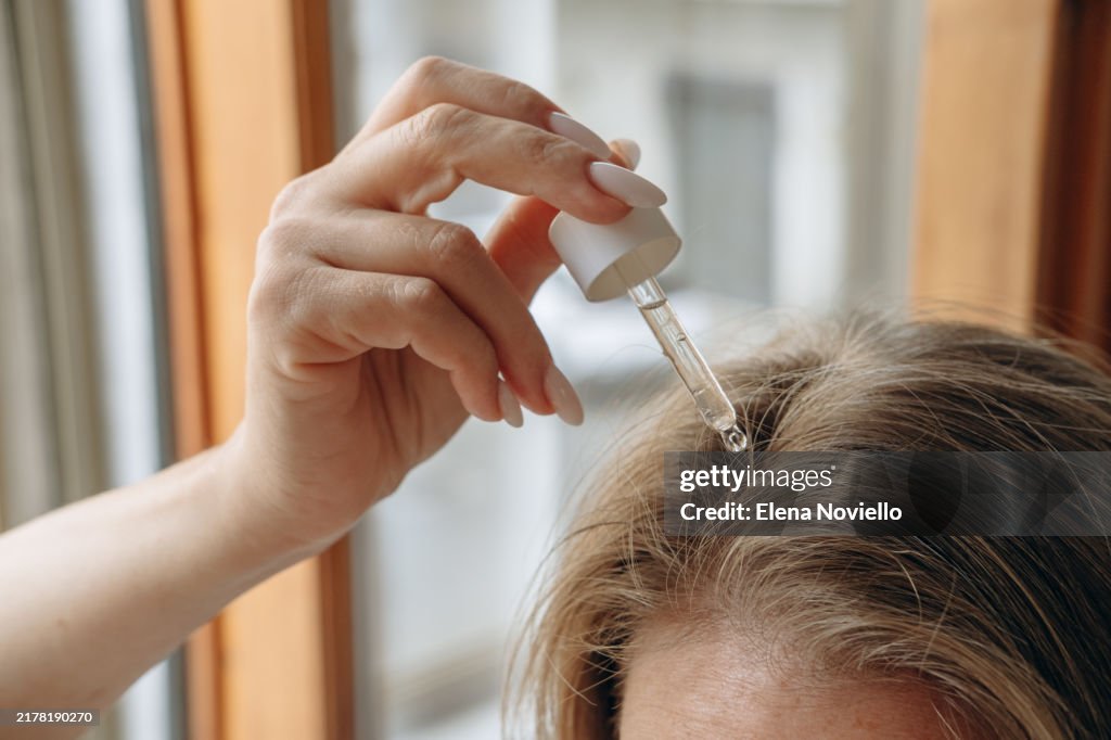 Close-up of a woman's hands with a pipette drops hair growth serum or hair oil with a dropper , hair care
