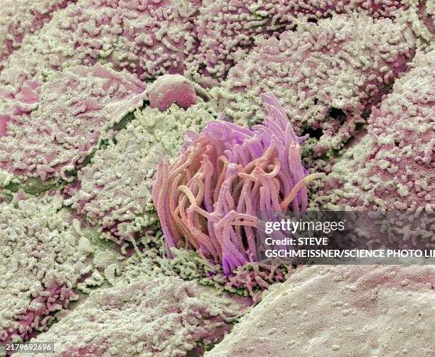 uterus, sem - sem stock pictures, royalty-free photos & images