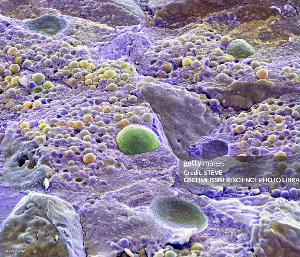Pancreas tissue, SEM