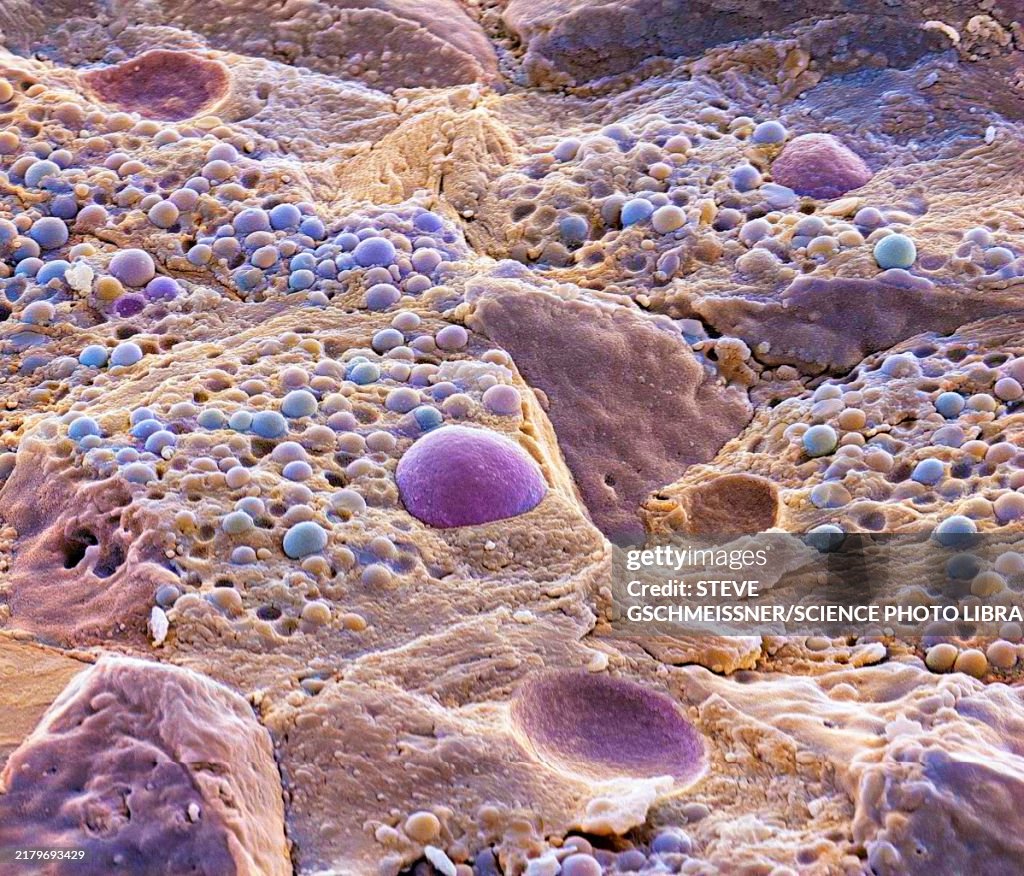Pancreas tissue, SEM