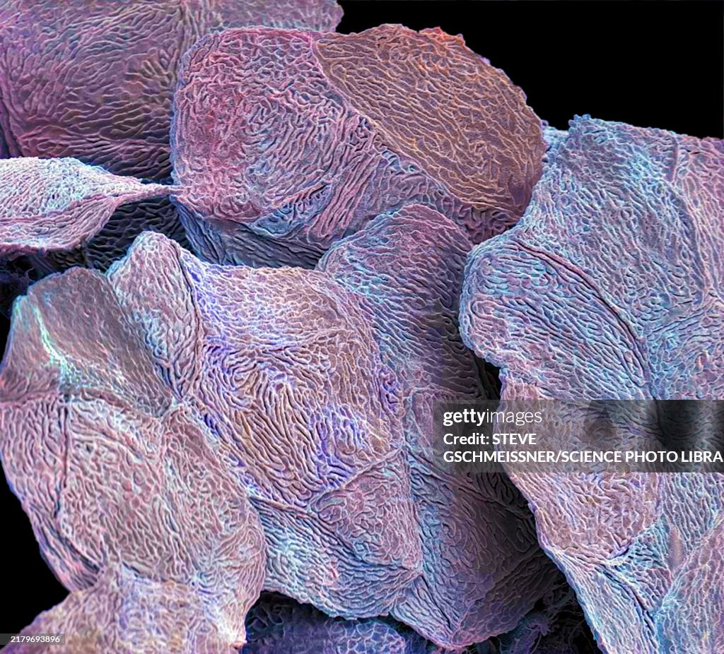Skin cells, SEM