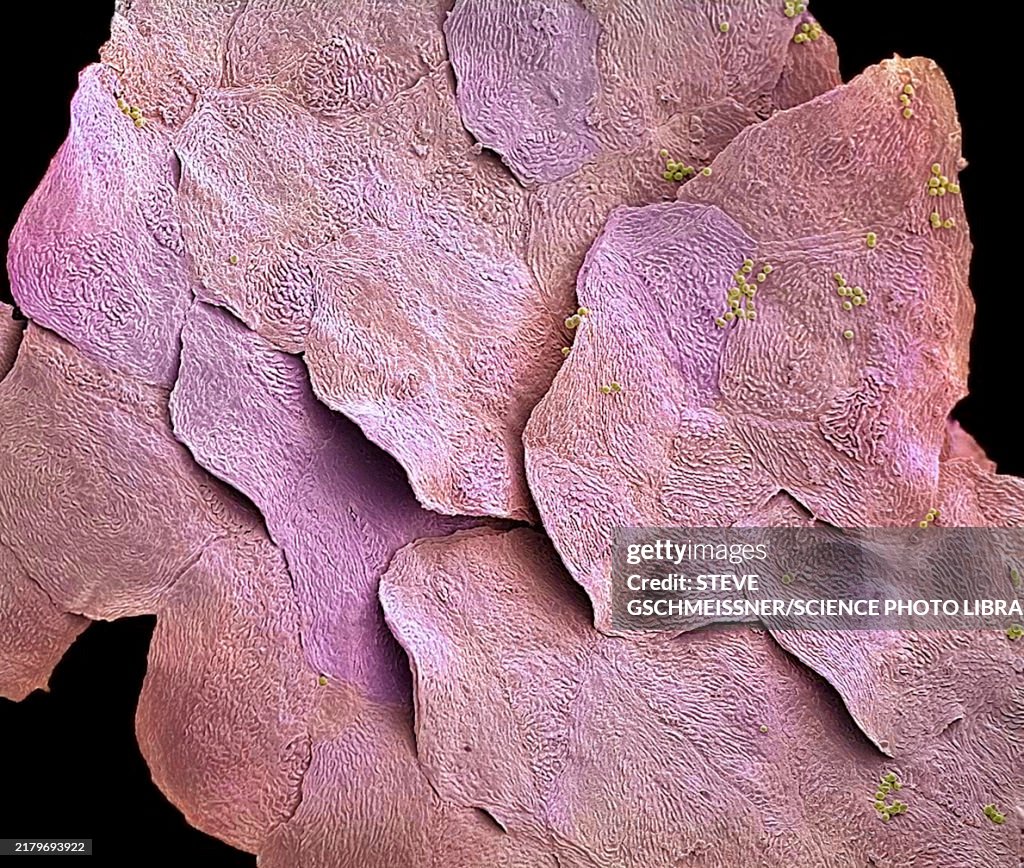 Skin cells, SEM