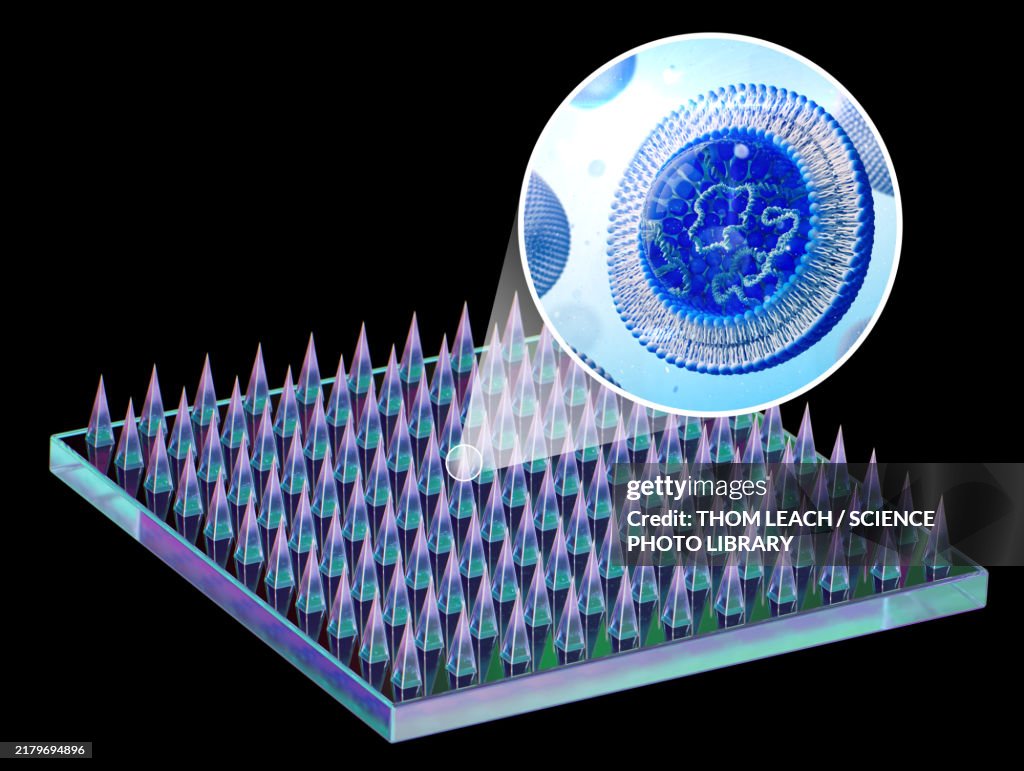 Microneedle mRNA vaccine, illustration