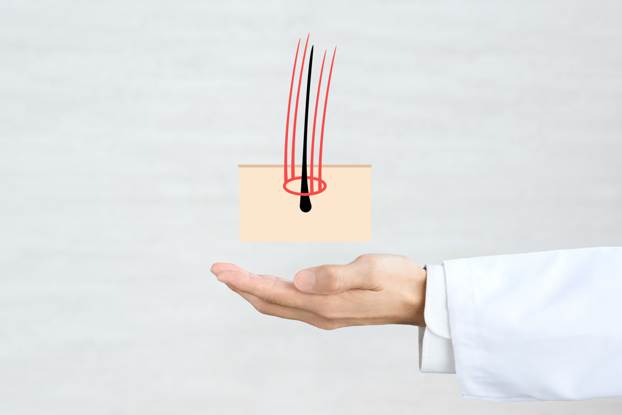 hair transplant consultation