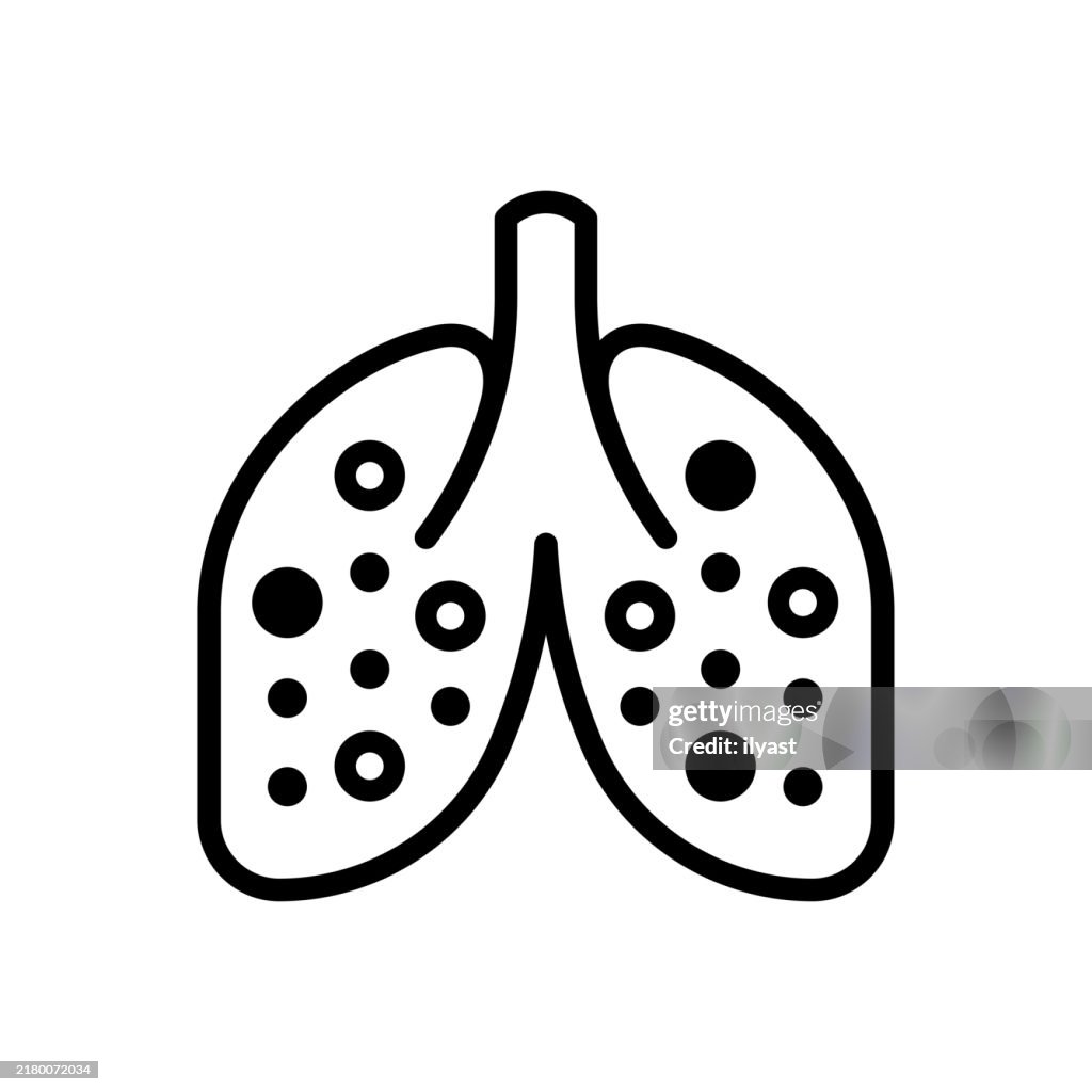 A simple line drawing of Lungs with Nodules