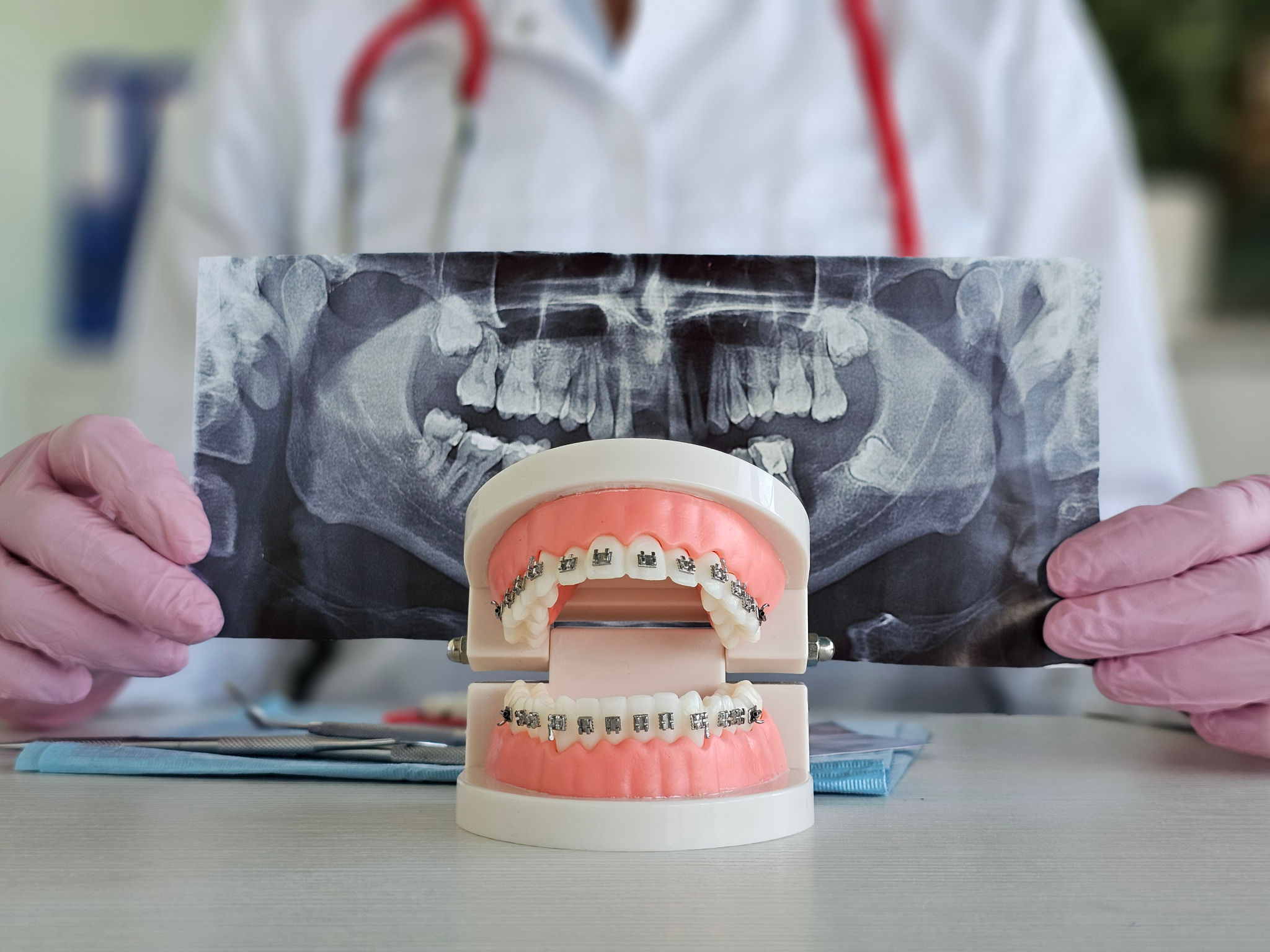 orthodontic consultation