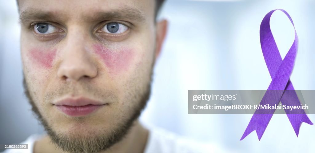 Man suffering from lupus, violet ribbon awareness symbol Pancreatic cancer, Alzheimer's disease, epilepsy, lupus, World Cancer Day