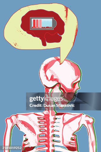 Over Working Body Overworked Body Cant Work Properly High-Res Vector Graphic - Getty Images
