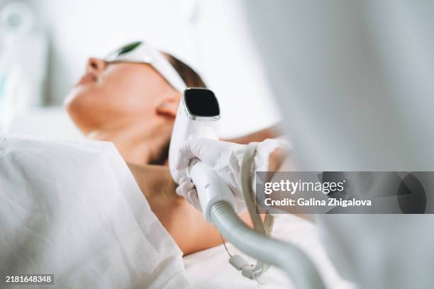 young woman in protective glasses getting removing hair from armpits with laser lying on couch in beauty salon - aparelho-de-soldar-a-laser imagens e fotografias de stock