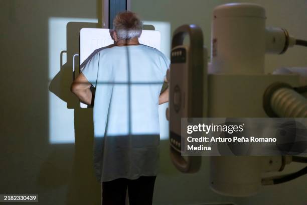 working with cervical x-rays - xray light box stock pictures, royalty-free photos & images