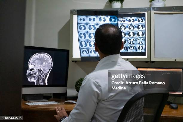 radiologist at his workplace - radiologist stock pictures, royalty-free photos & images