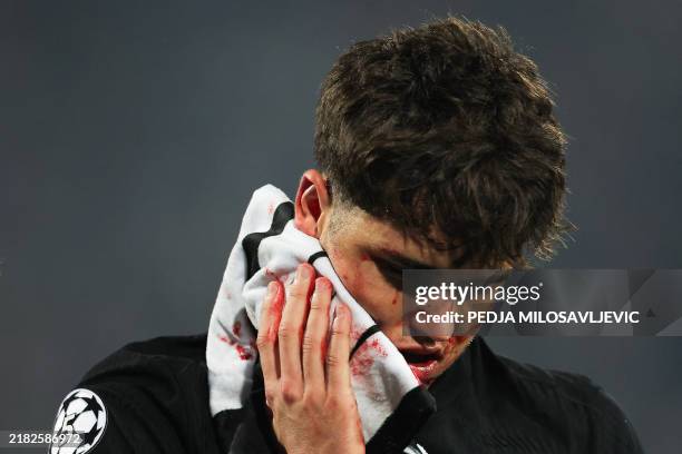 Barcelona's Spanish defender Pau Cubarsi leaves the pitch after suffering an injury during the UEFA Champions League, League phase - Matchday 4...
