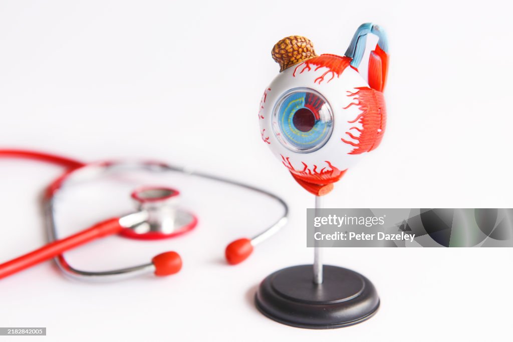 Anatomical teaching model of human eyeball