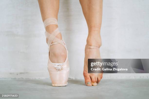 the legs of real ballerina in pointe shoes and without in studio - irritation cutanée photos et images de collection