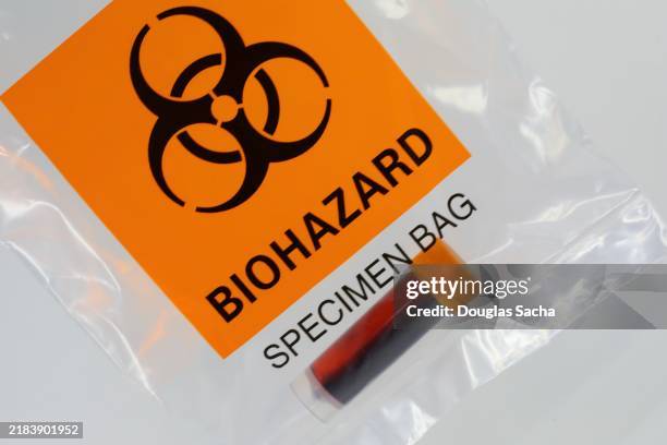 hazardous bodily fluid sample - sustancia con riesgo biológico fotografías e imágenes de stock