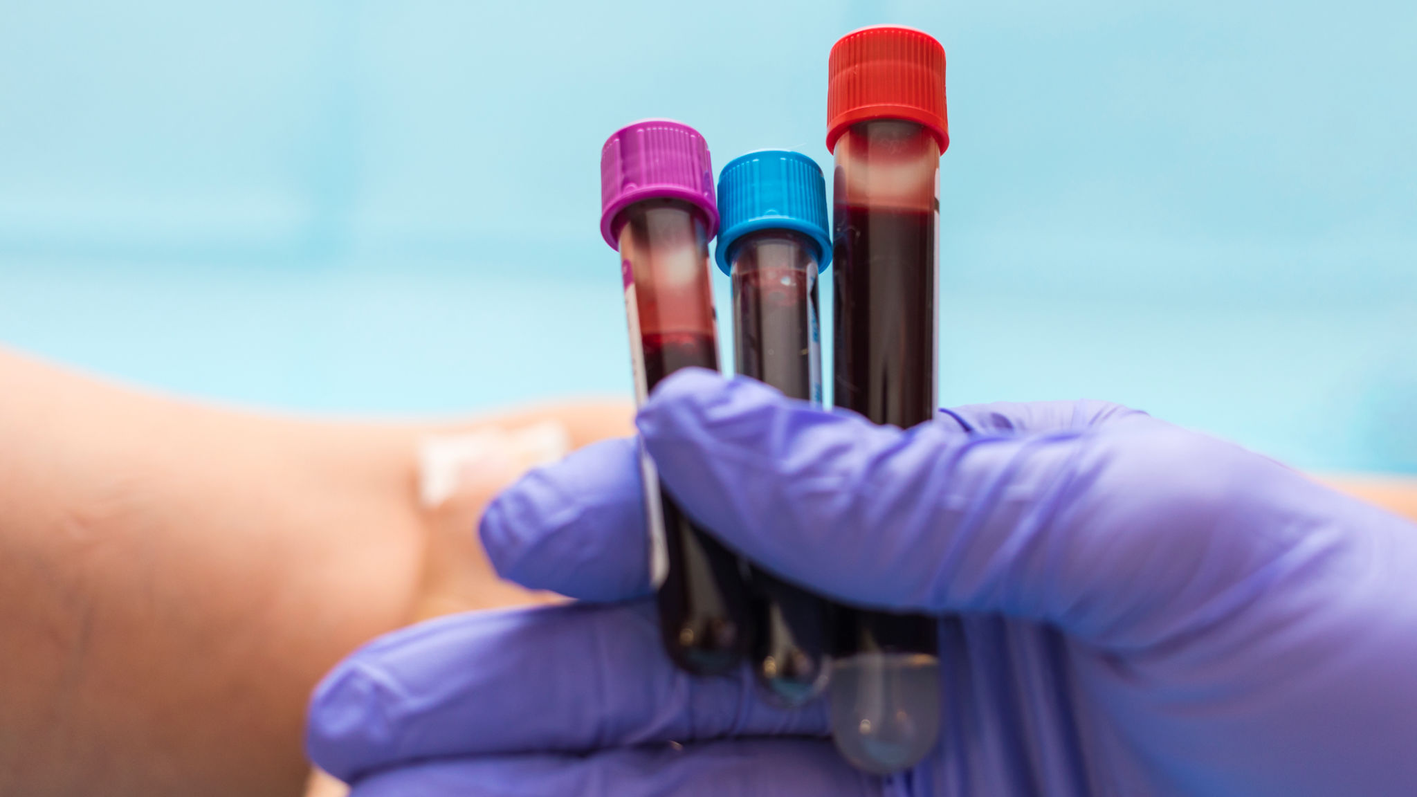 blood test