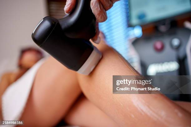 leg laser treatment in a spa setting - bare feet office stock pictures, royalty-free photos & images