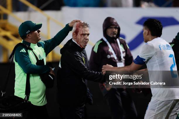 Javier Aguirre, Head Coach of Mexico, leaves the pitch with a head injury due to a bottle thrown by Honduras' fans during the CONCACAF Nations League...