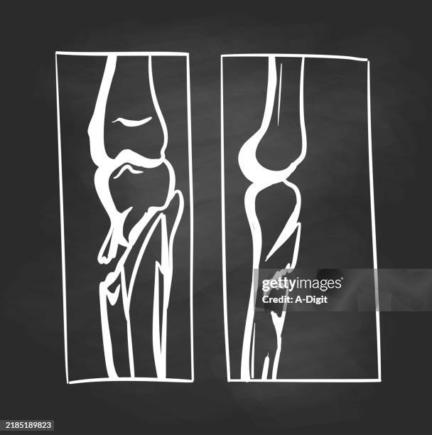 Tibia Release Graphics 85 Tibia High Res Vector Graphics - Getty Images