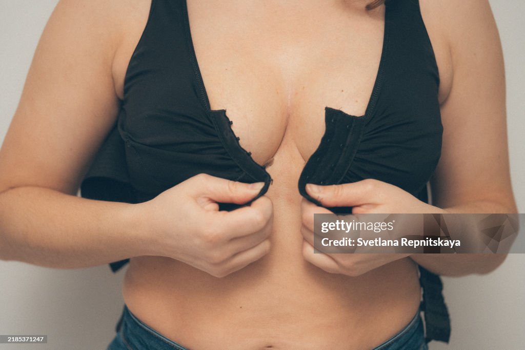 Woman applying on a bandage after mammoplasty