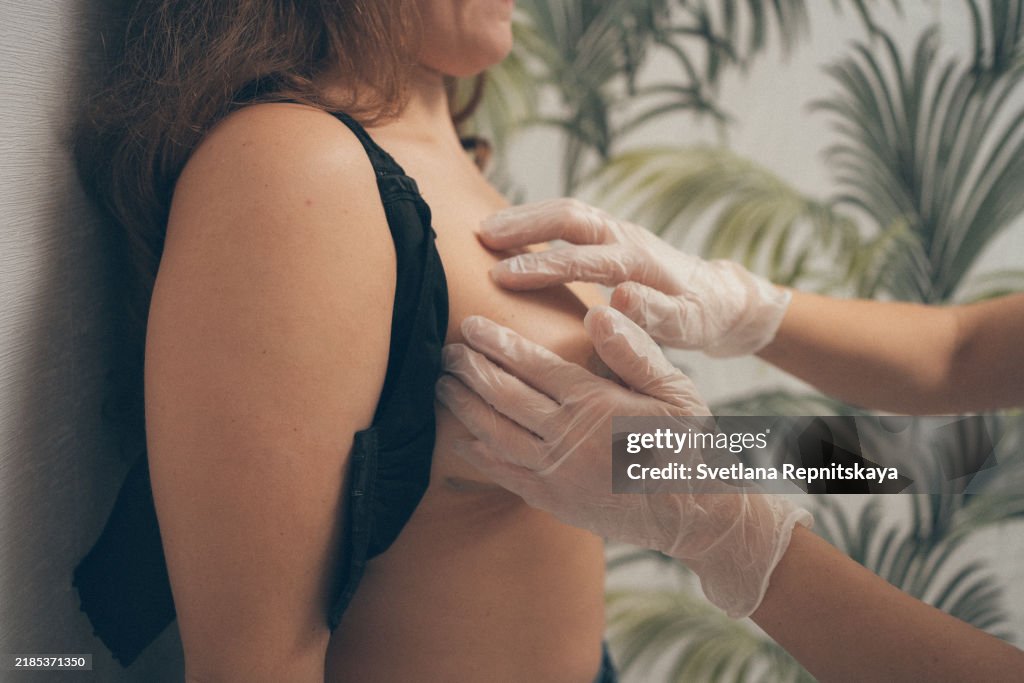 Female doctor surgeon in surgical gloves examines the stitches of a patient after plastic surgery, mammoplasty, breast augmentation