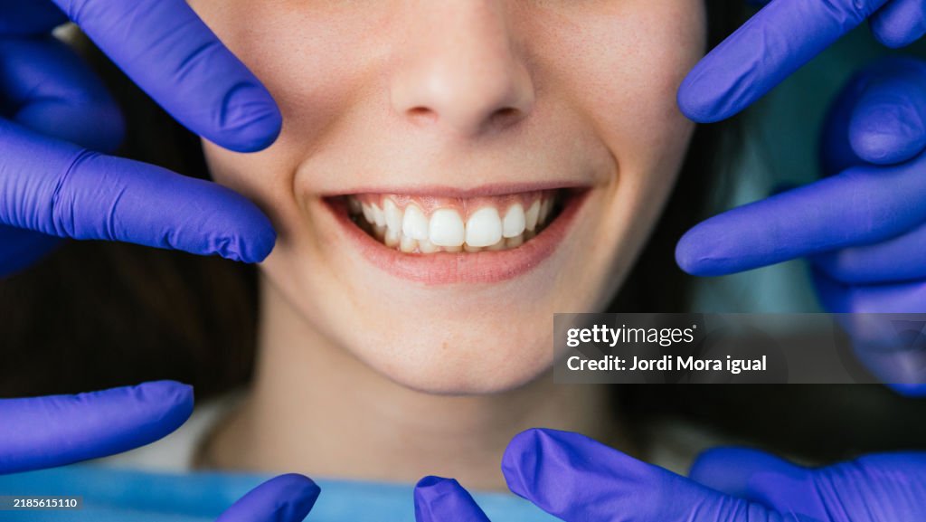 Dentist showing perfect teeth of young woman smiling at the dental clinic
