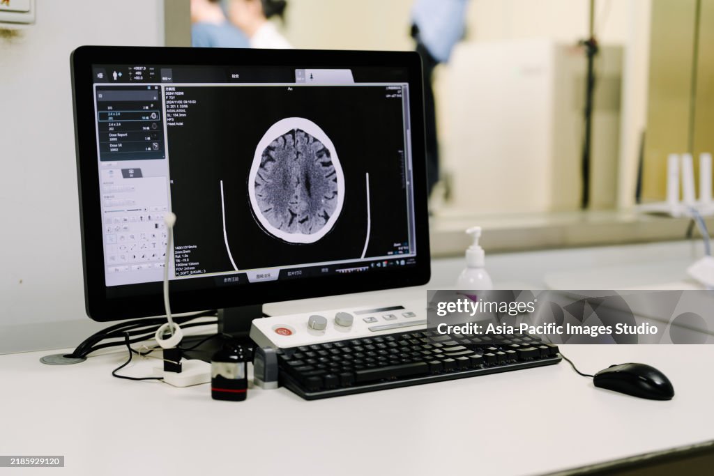 Hospital CT Scanner. Analyzing x-ray or scan radiography in hospital.