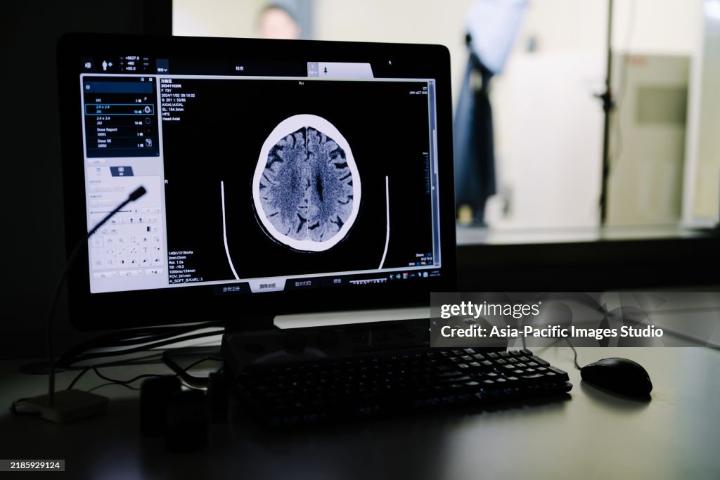 Hospital CT Scanner. Analyzing x-ray or scan radiography in hospital.