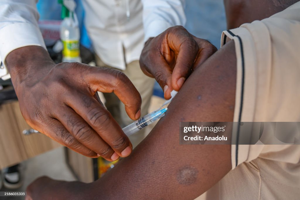 Nigeria launches vaccination campaign against Mpox