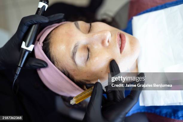 esteticista aplicando plasma rico en plaquetas con dermapen durante el tratamiento facial - plasma rico en plaquetas fotografías e imágenes de stock