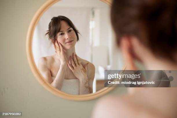 frau, die sich selbst in den spiegel schaut - vitiligo stock-fotos und bilder