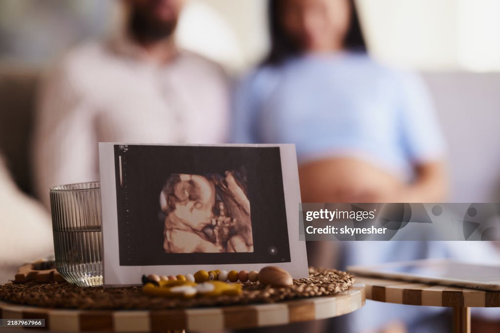 3D ultrasound of a baby!
