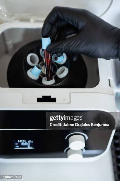 esteticista preparando plasma rico en plaquetas con centrífuga para el tratamiento con dermapen - plasma rico en plaquetas fotografías e imágenes de stock