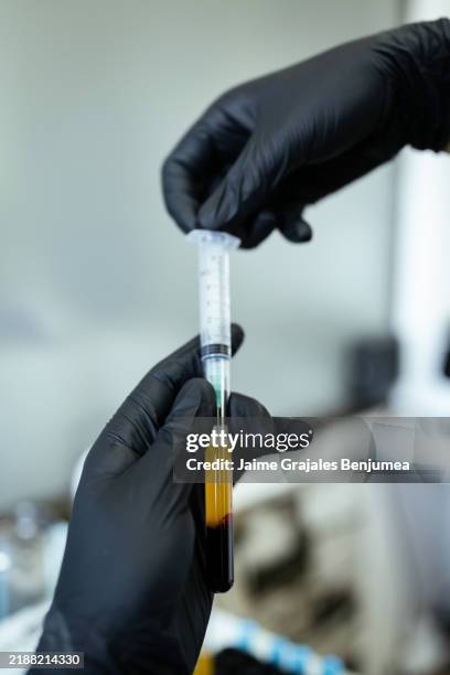médico que prepara plasma rico en plaquetas (prp) para el tratamiento con dermapen - plasma rico en plaquetas fotografías e imágenes de stock